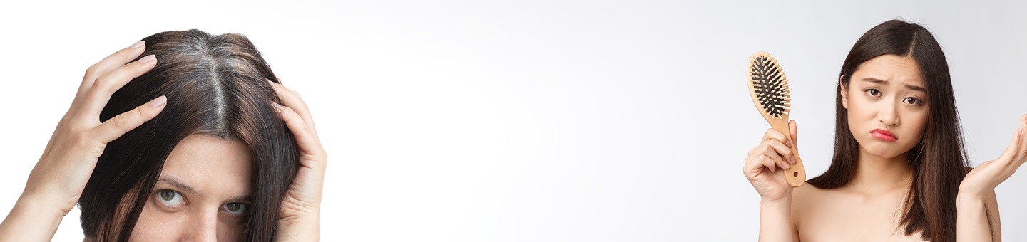 Hair Thinning vs Hair Loss – What’s the Difference & How to Treat It?